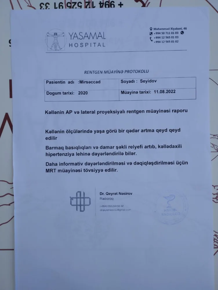 "Mərhəmətli insanlar, yeganə balamı ölməyə qoymayın" - 2 yaşlı Mirsəccadın - YARDIMA ehtiyacı var - FOTO/VİDEO
