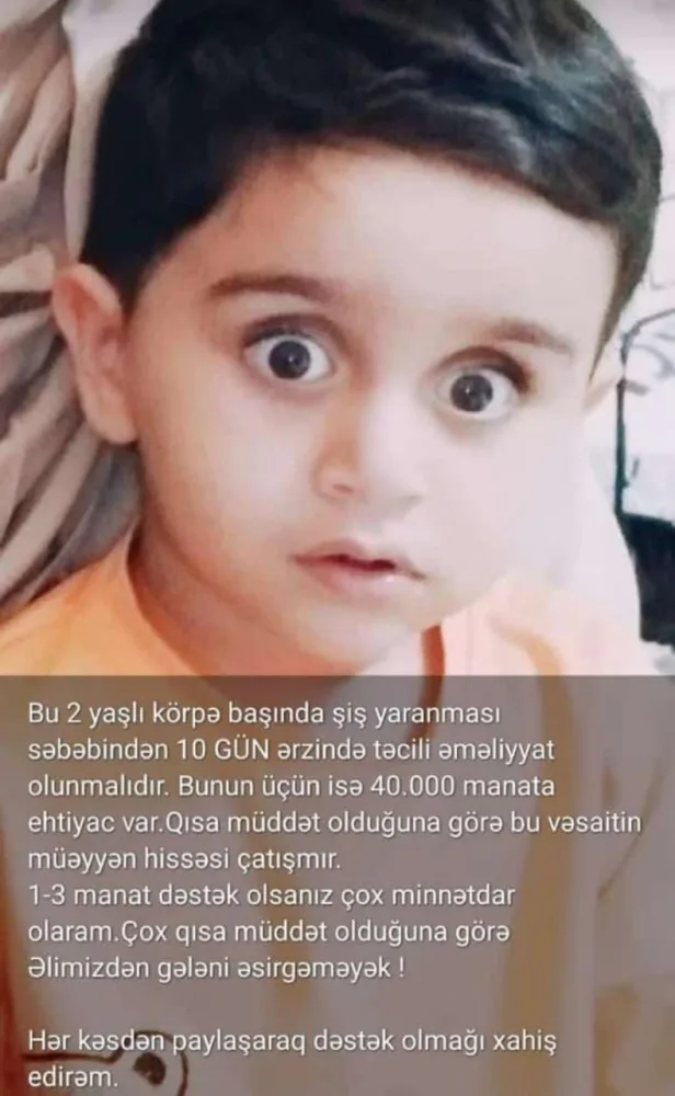 "Mərhəmətli insanlar, yeganə balamı ölməyə qoymayın" - 2 yaşlı Mirsəccadın - YARDIMA ehtiyacı var - FOTO/VİDEO