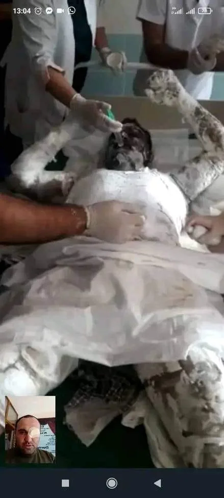 Azərbaycanda qazi İcra Hakimiyyətinin önündə ÖZÜNÜ YANDIRDI: - Dəhşətli FOTO