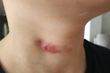 Azərbaycanda dəhşətli hadisə: 10 yaşlı uşağın yediyi boğazından çölə tökülür