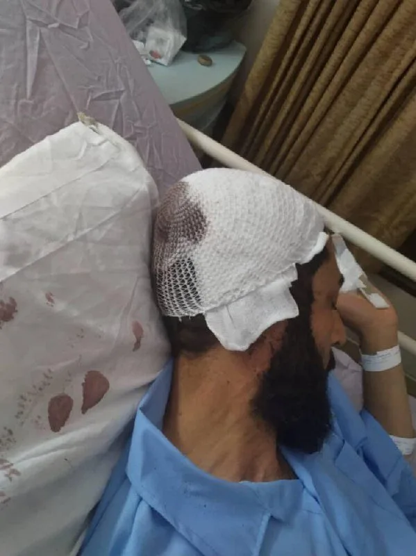 İranda iki molla dəmir boru ilə döyüldü - FOTO
