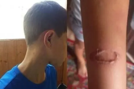 Anası tərəfindən döyülən Polad sığınacağa yerləşdirildi - FOTO