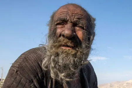 "Dünyanın ən çirkli adamı" öldü - FOTO