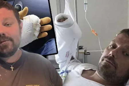 Pişik barmağını dişlədi, 15 dəfə əməliyyat olundu, lakin sonda - ÖLDÜ