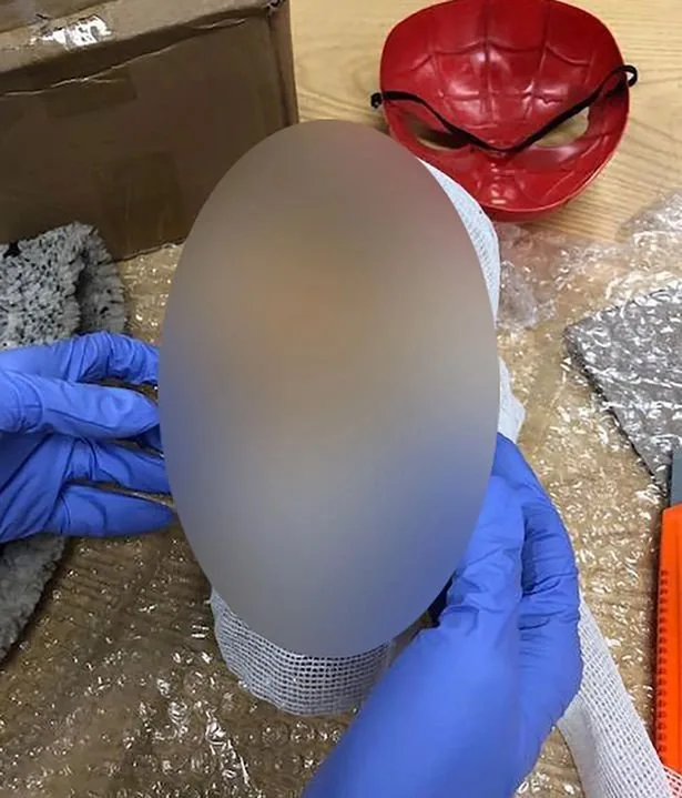 Gömrükdə dəhşət: Qutudan kəsilmiş uşaq başı çıxdı