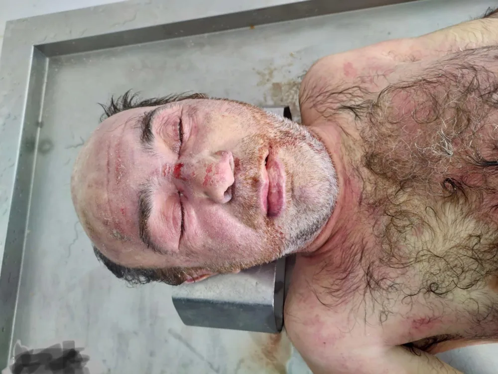 Mərdəkanda binanın həyətində naməlum kişi meyiti tapılıb