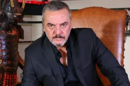 Məşhur aktyorun barmaqları - QIRILDI