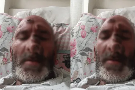 Milçək dişləməsi onu tanınmaz hala saldı