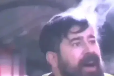 Başından tüstü çıxan şəxs danışdı: - "Sol qulağım qopmuşdu, amma..." - FOTO - VİDEO