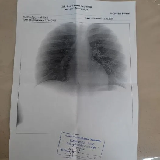 "Bu həkim deyilən şəxs soruşmayıb ki, bala bəlkə bu elə axıncı pulundur..."