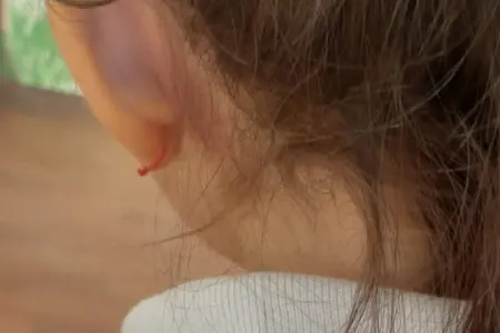 7 yaşlı məktəbli zorakılığa məruz qalıb - FOTO/YENİLƏNDİ