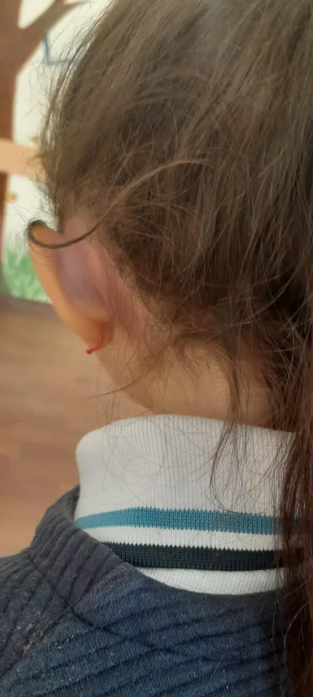 7 yaşlı məktəbli zorakılığa məruz qalıb - FOTO/YENİLƏNDİ