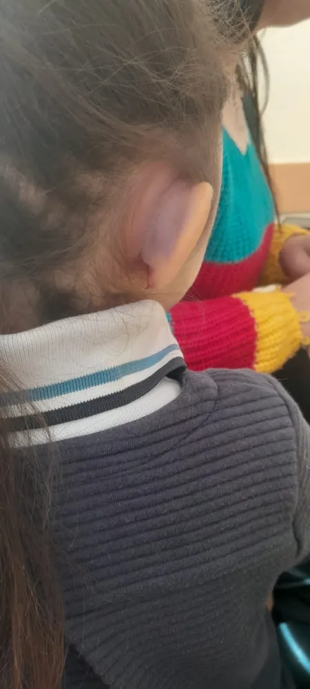 7 yaşlı məktəbli zorakılığa məruz qalıb - FOTO/YENİLƏNDİ