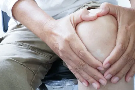 Sümük qırılmalarına qarşı nə etmək olar? - Həkimlər açıqladı