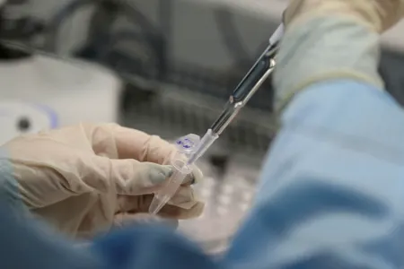 Naməlum yoluxucu infeksiya yayıldı - ÖLƏNLƏR VAR
