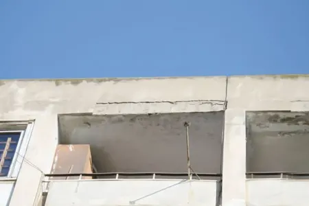 Tanınmış aktrisanın başına daş düşdü - FOTO