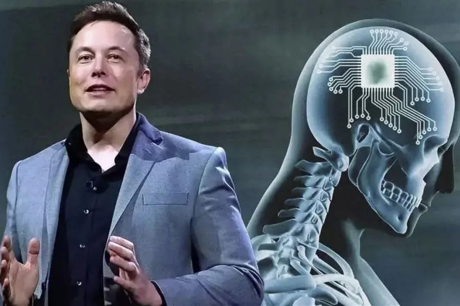 Beyin implantı üçün tərəfdaş axtarılır