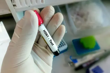 Quş qripi mutasiyaya uğradı: - Daha yoluxucu və ölümcül ola bilər