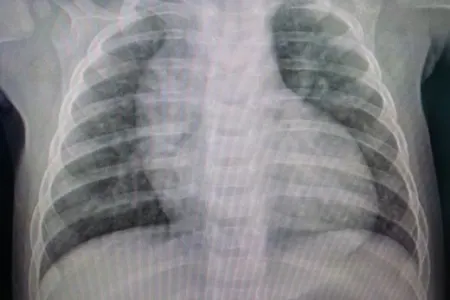 1 yaşlı qızın ürəyinin ölçüsü hər kəsi - TƏƏCCÜBLƏNDİRDİ - FOTO
