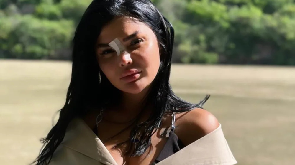 Könülün oğlu ilə eşq yaşadığı iddia olunan müğənnini döyüblər? - FOTO