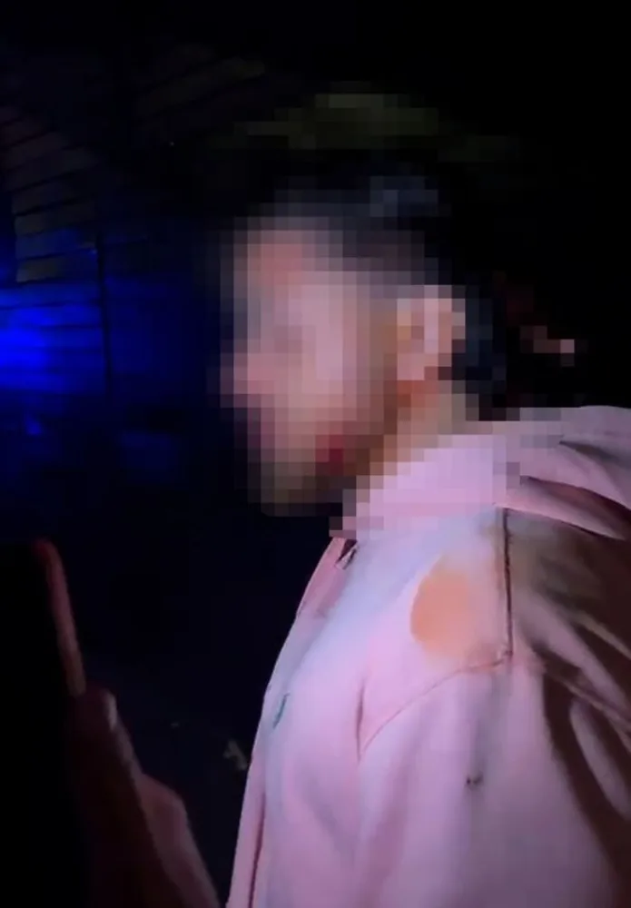 PKK tərəfdarları səs verən gənci yaraladı
