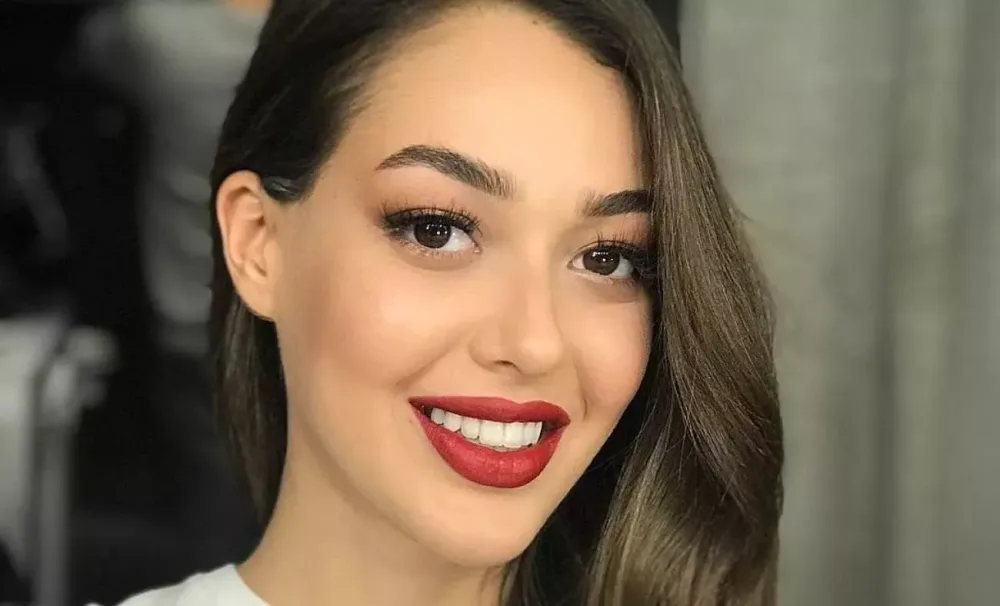 Məşhur aktrisa tanınmaz halda - FOTOLAR