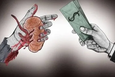 İnsan orqanlarının satışı artdı- - ACINACAQLI VƏZİYYƏT