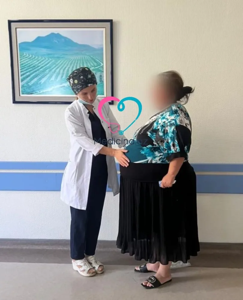 Azərbaycanda xəstənin qarnından 32 kq-lıq kista çıxarıldı - FOTO/VİDEO