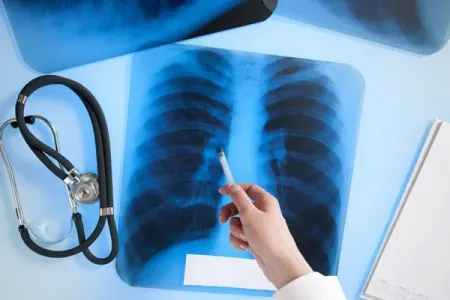 Yaşayış binalarındakı tibb müəssisələri radiasiya təhlükəsi yaradırmı?