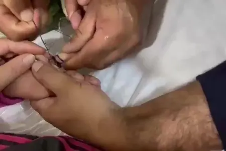 Bərdədə uşağın barmağı dəmir halqanın arasında sıxışdı - VİDEO