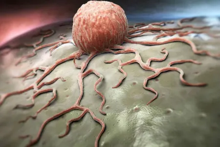 Məşhur aktrisada xərçəng aşkarlandı - FOTO