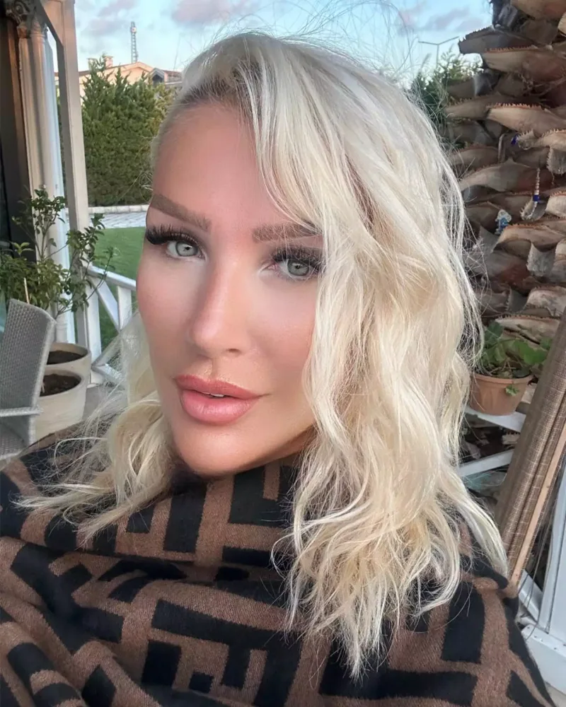 Üzünə sünnət dərisi vurdurdu - FOTO