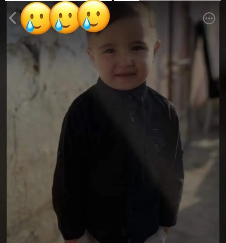 Qızılcadan vəfat edən iki yaşlı Elmirin - FOTOSU