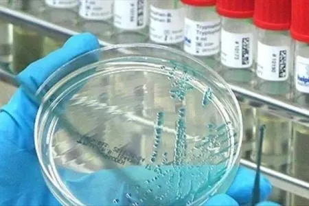 Ağız xərçənginin ilk əlamətləri...