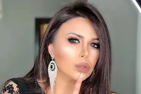 “Pişik Günel” əməliyyat olundu - VİDEO