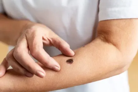 Onkologiyanın “qara kraliçası” – bədəndə harda gizlənir?