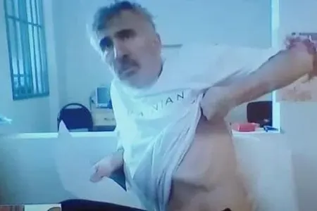 Saakaşvilinin səhhətində mühüm irəliləyiş