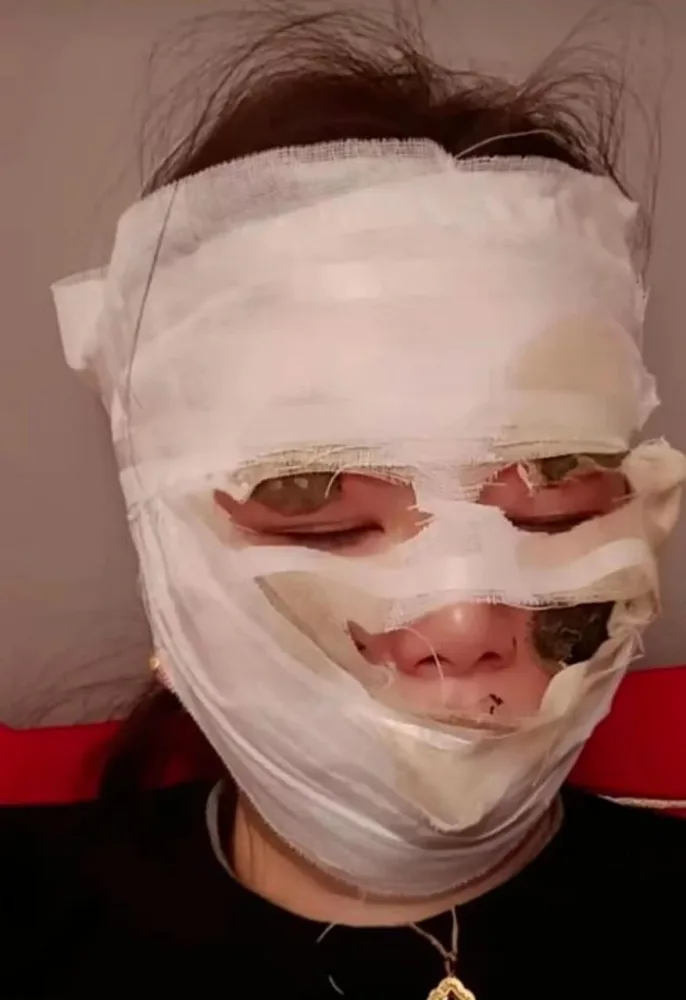 Toyda dəhşət yaşandı - Qonaqlar gəlinə elə şey etdi ki... - FOTOlar