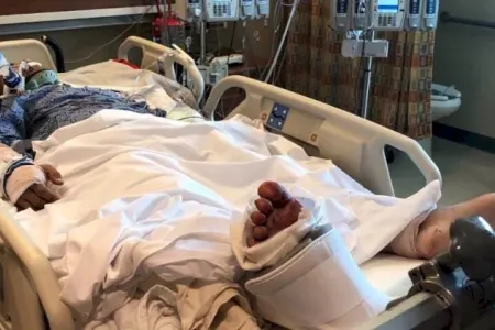 Partlayışda xəsarət alan 9 nəfərin vəziyyəti ağırdır - TƏBİB