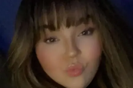 Mədəkiçiltmə əməliyyatı etdirən qız öldü - FOTO