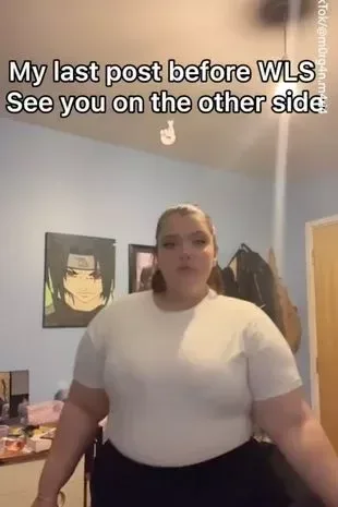 Mədəkiçiltmə əməliyyatı etdirən qız öldü - FOTO