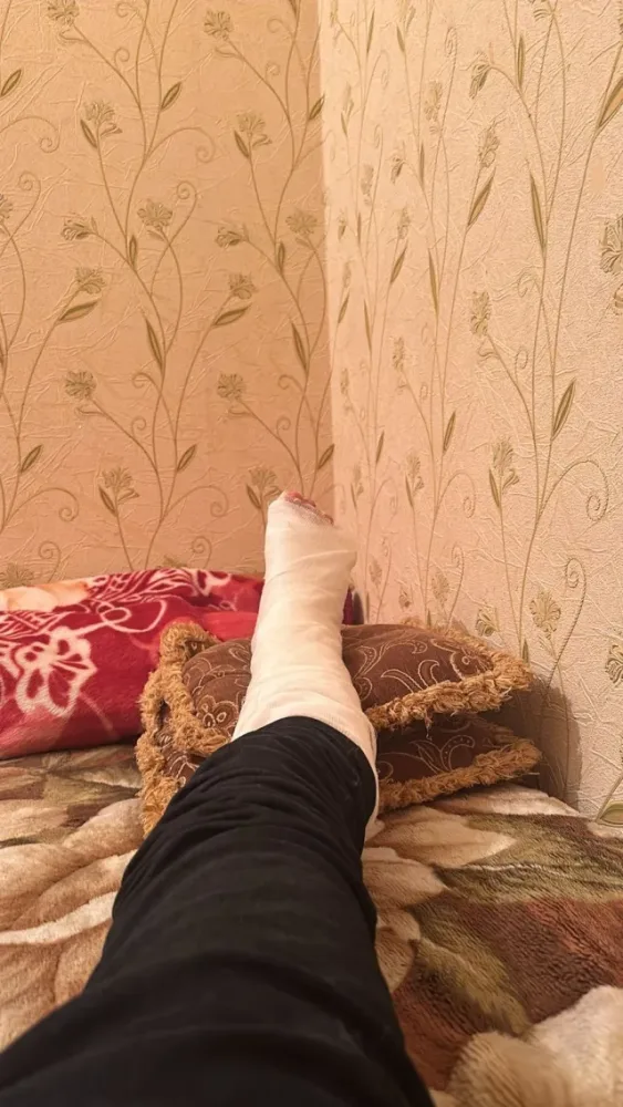 Abonent “Azəriqaz”ın əməkdaşının barmağını qırdı - – FOTO