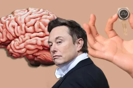 Musk: "Beyninə çip yerləşdirilmiş şəxs.."