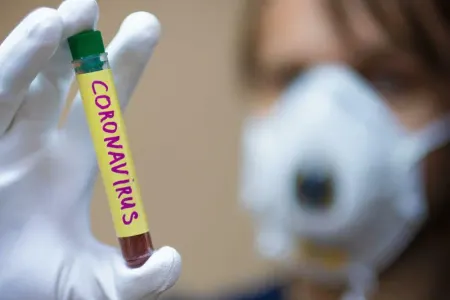 Mütəxəssis COVID-19 olanlara xəbərdarlıq etdi