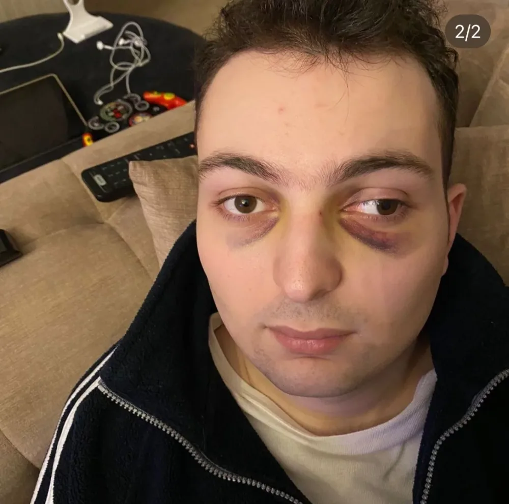 Bakıda DƏHŞƏT - Autizmli yeniyetmə - DÖYÜLDÜ