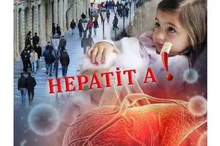 Məktəbli hepatit A-ya yoluxdu