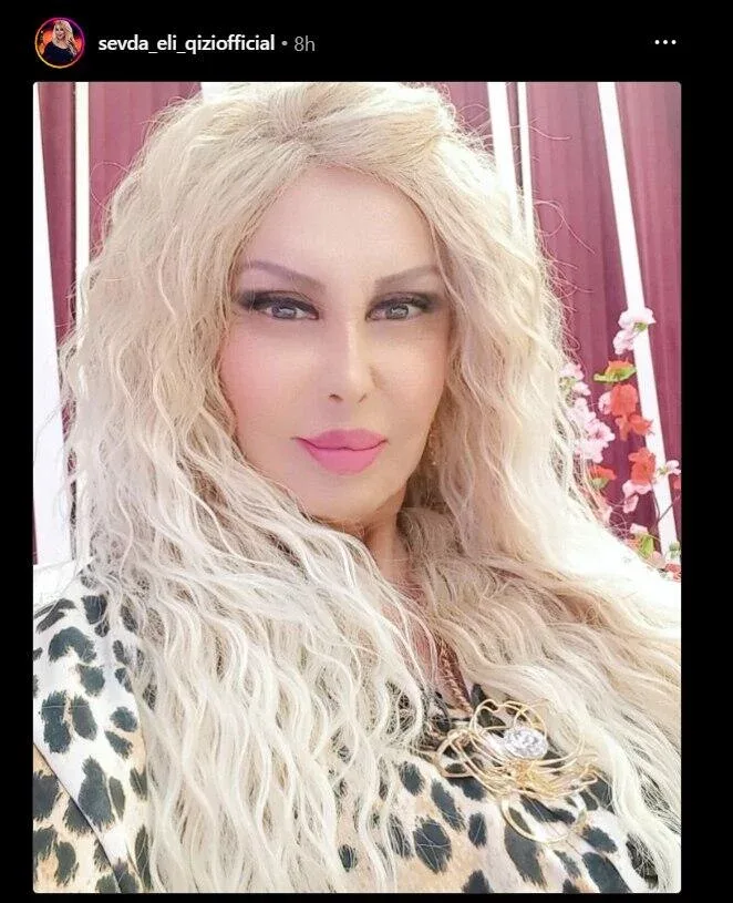 Sevda Əliqızı özünü tanınmaz hala saldı - – FOTO