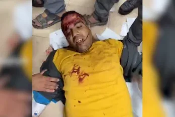 Tanınmış jurnalist ayağını itirdi - FOTO