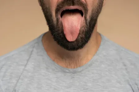 Sağlam insanın dili belə görünür