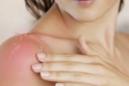 Günəşlənmənin təhlükəli - TƏRƏFLƏRİ